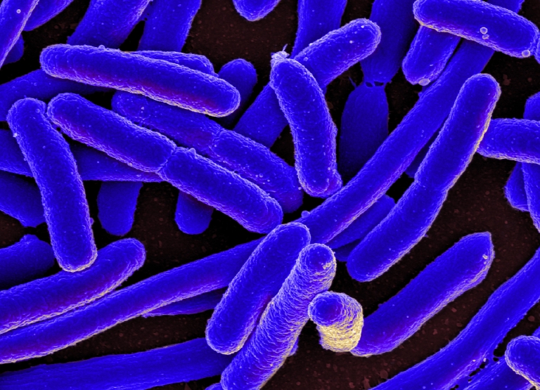 E. coli. (Photo courtesy of the National Institute of Allergy and Infectious Diseases)