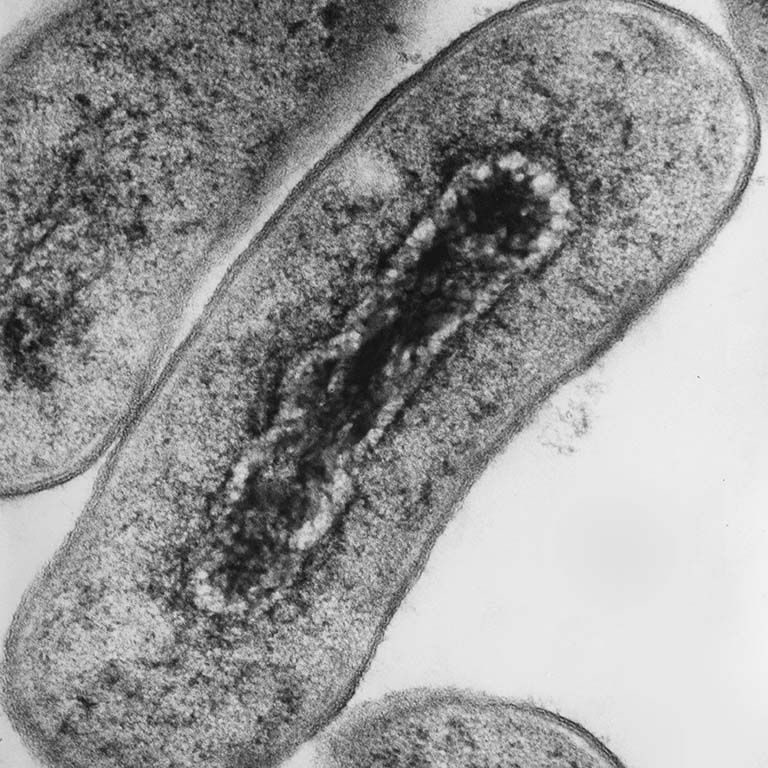 Cross section of Escherichia coli bacteria under transmission electron microscopy. Adobe Stock photo #196637990
