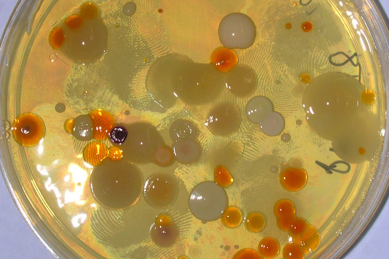 Petri dish of KBS soil isolates.