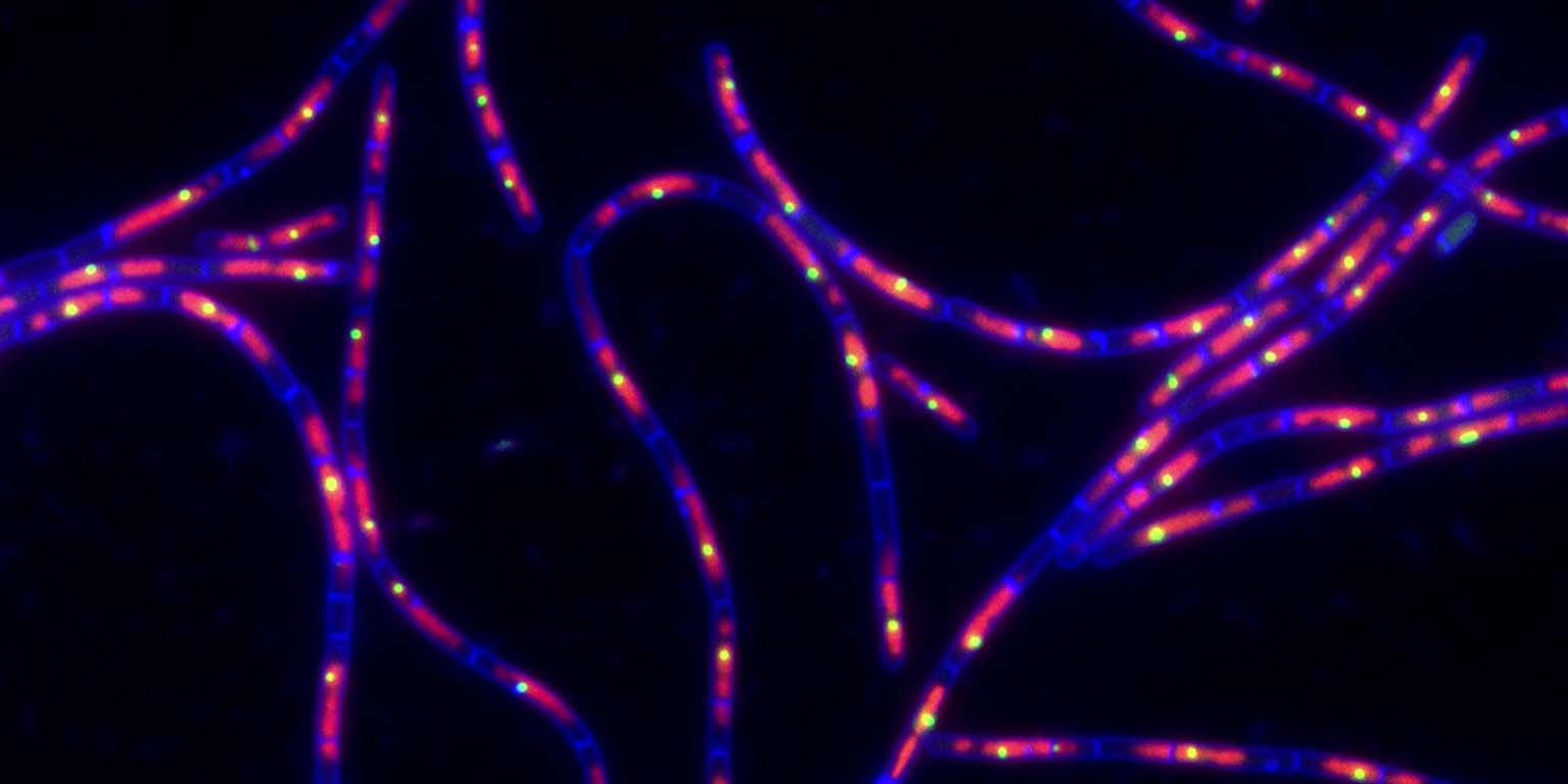 Bacillus subtilis cells (blue) show unsegregated DNA (red) and replication origins (green) in the absence of the SMC complex.