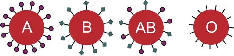 Each blood type is distinguished by a different sugar marker on the red blood cell. The diagram shows four red circles, each labelled with one of the four blood types: A, B, AB, and O. From the A cell extends pegs, each peg with a circle at its end, representing the sugar marker. From the B cell are pegs with squares on their ends, representing a different sugar marker.  The AB cell contains both circle-ended and square-ended pegs. The O cell contains only pegs.